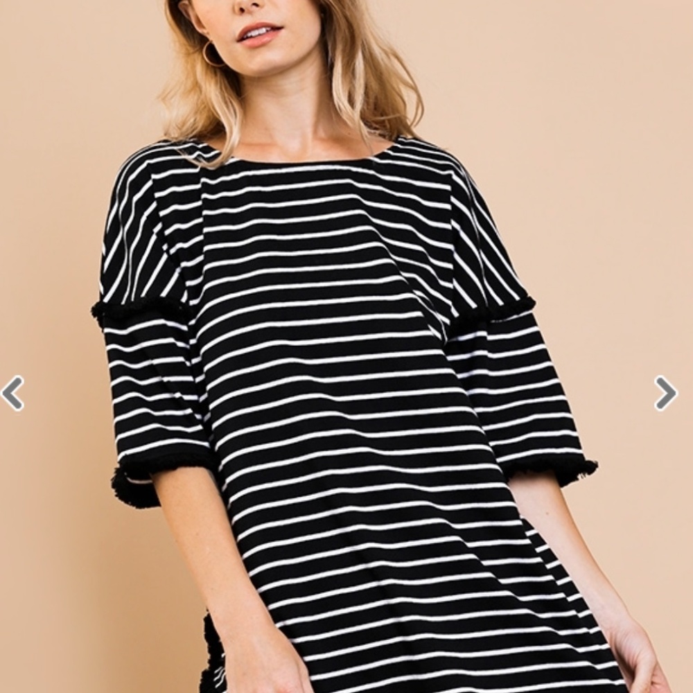 Striped Tunic